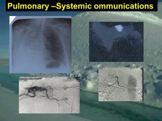 Pulmonary –Systemic ommunications
 