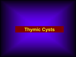 Thymic Cysts
 