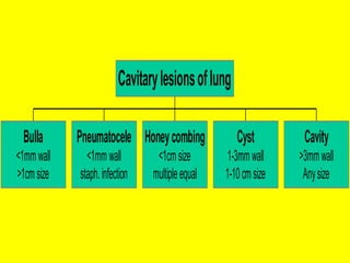 Bulla
<1mmwall
>1cmsize
Pneumatocele
<1mmwall
staph.infection
Honeycombing
<1cmsize
multipleequal
Cyst
1-3mmwall
1-10cmsize
Cavity
>3mmwall
Anysize
Cavitarylesionsoflung
 