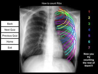 How To Count Ribs Chest radiology quiz | PPS