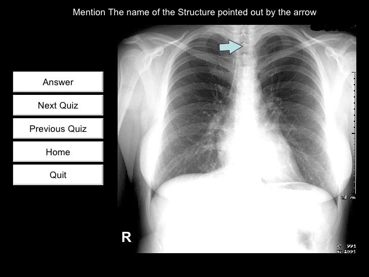 Chest radiology quiz