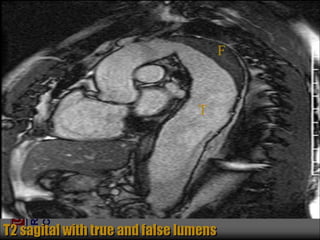 Chest Review (#1 - 76).ppt