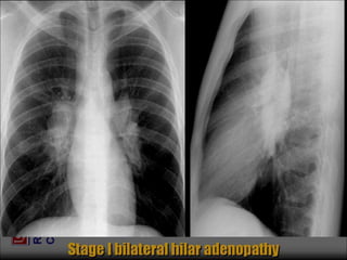 Chest Review (#1 - 76).ppt