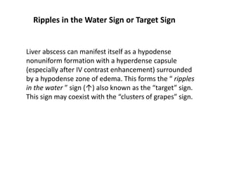 Normal Puddle Sign Chest signs spotters in xray andbct.pptx
