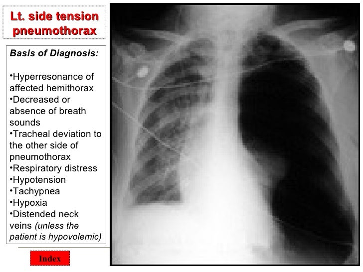 Chest surgical pathology &x rays