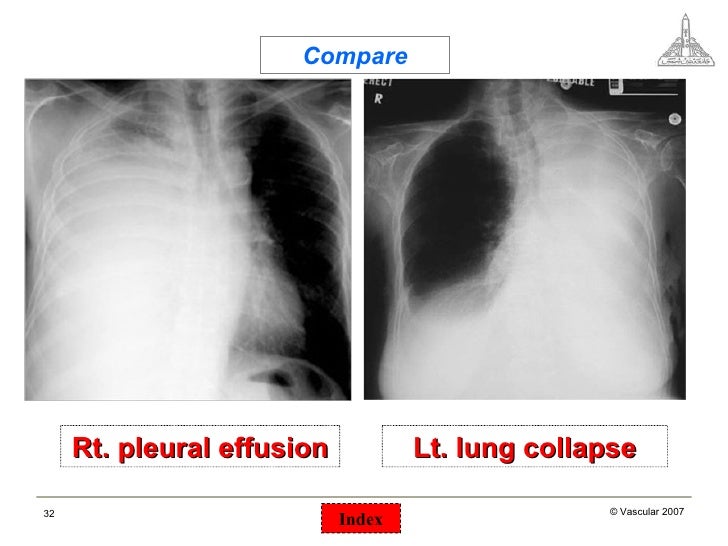 Chest surgical pathology &x rays
