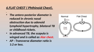 6.FLAT CHEST ( Phthinoid Chest).
? The antero-posterior diameter is
reduced in chronic nasal
obstruction due to adenoid
lymphoid hypertrophy, bilateral TB
or childhood rickets.
? In advanced TB, the scapula is
winged and is called as Alar chest.
? AP : Transverse diameter ratio is
1:2 or less.
 