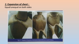 2. Expansion of chest :
Equal/unequal on both sides
 