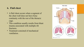 CHEST TRAUMA-1.pptxhdbbdnznanjwinajcigkkgktk | PPTX