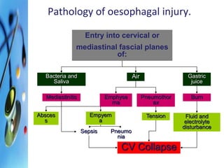 Pathology of oesophagal injury. 
Entry into cervical or 
mediastinal fascial planes 
of: 
Air Gastric 
juice 
Bacteria and 
Saliva 
Mediastinitis Emphyse 
ma 
Pneumothor 
ax 
Burn 
Absces 
s 
Empyem 
a 
Sepsis Pneumo 
nia 
Tension Fluid and 
electrolyte 
disturbance 
CV Collapse 
 