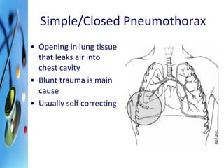 Simple/Closed Pneumothorax 
• Opening in lung tissue 
that leaks air into 
chest cavity 
• Blunt trauma is main 
cause 
• Usually self correcting 
 