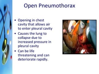 Open Pneumothorax 
• Opening in chest 
cavity that allows air 
to enter pleural cavity 
• Causes the lung to 
collapse due to 
increased pressure in 
pleural cavity 
• Can be life 
threatening and can 
deteriorate rapidly. 
 