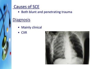 Causes of SCE 
• Both blunt and penetrating trauma 
Diagnosis 
• Mainly clinical 
• CXR 
 