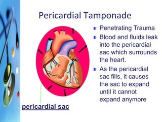 Pericardial Tamponade 
Penetrating Trauma 
Blood and fluids leak 
into the pericardial 
sac which surrounds 
the heart. 
As the pericardial 
sac fills, it causes 
the sac to expand 
until it cannot 
expand anymore 
pericardial sac 
 