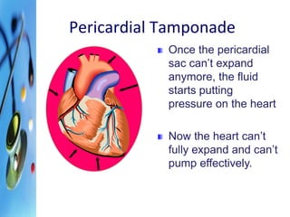 Pericardial Tamponade 
Once the pericardial 
sac can’t expand 
anymore, the fluid 
starts putting 
pressure on the heart 
Now the heart can’t 
fully expand and can’t 
pump effectively. 
 