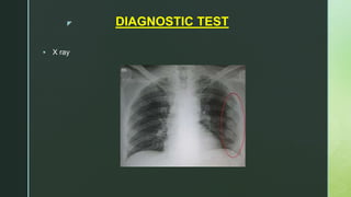 z DIAGNOSTIC TEST
 X ray
 