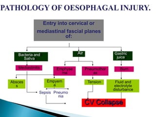 Entry into cervical or
mediastinal fascial planes
of:
Air Gastric
juice
Bacteria and
Saliva
Sepsis Pneumo
nia
CV Collapse
 