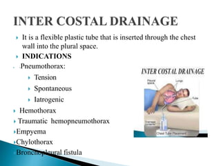  It is a flexible plastic tube that is inserted through the chest
wall into the plural space.
 INDICATIONS
 -Pneumothorax:
 Tension
 Spontaneous
 Iatrogenic
 Hemothorax
 Traumatic hemopneumothorax
Empyema
Chylothorax
Bronchopleural fistula
 