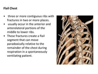 Chest trauma | PPT