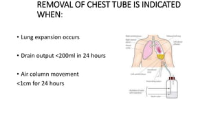 REMOVAL OF CHEST TUBE IS INDICATED
WHEN:
• Lung expansion occurs
• Drain output <200ml in 24 hours
• Air column movement
<1cm for 24 hours
 