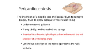 Pericardiocentesis
The insertion of a needle into the pericardium to remove
blood / fluid to allow adequate ventricular filling
• Under ultrasound guidance
• A long 18-22g needle attached to a syringe
• Inserted into the sub xiphoid space directed towards the left
shoulder at a 40 degree angle
• Continuous aspiration as the needle approaches the right
ventricle.
 