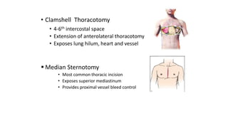 • Clamshell Thoracotomy
• 4-6th intercostal space
• Extension of anterolateral thoracotomy
• Exposes lung hilum, heart and vessel
 Median Sternotomy
• Most common thoracic incision
• Exposes superior mediastinum
• Provides proximal vessel bleed control
 
