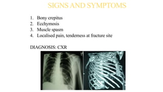 SIGNSAND SYMPTOMS
1. Bony crepitus
2. Ecchymosis
3. Muscle spasm
4. Localised pain, tenderness at fracture site
DIAGNOSIS: CXR
 