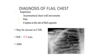 DIAGNOSIS OF FLAIL CHEST
• Inspection:
• Asymmetrical chest wall movements
• Pain
• Crepitus at the site of flail segment
• May be missed on CXR.
• IOC: CT scan.
• ABG
 