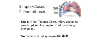 Simple/Closed
Pneumothorax
Due to Blunt Trauma Chest, injury occurs to
parietal pleura leading to paradoxical lung
movement.
No mediastinal /diaphragmatic shift
 