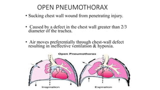 OPEN PNEUMOTHORAX
• Sucking chest wall wound from penetrating injury.
• Caused by a defect in the chest wall greater than 2/3
diameter of the trachea.
• Air moves preferentially through chest-wall defect
resulting in ineffective ventilation & hypoxia.
 