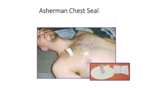 Asherman Chest Seal
 