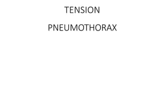 TENSION
PNEUMOTHORAX
 