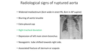 Radiological signs of ruptured aorta
• Widened mediastinum (6cm wide in erect PA, 8cm in AP supine)
• Blurring of aortic knuckle
• Extra pleural cap
• Right tracheal deviation
• Depression of left main strem bronchus
• Nasogastric tube shifted towards right side.
• Associated fracture of sternum or scapula
 