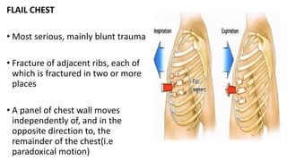 Two Adject Ribs CHEST TRAUMA.pptx