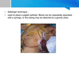 • Seldinger technique :
• used to place a pigtail catheter. Blood can be repeatedly aspirated
with a syringe, or the tubing may be attached to a gravity drain.
 
