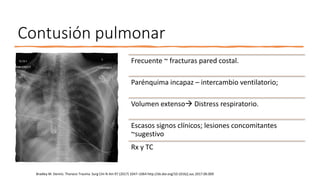Contusión pulmonar
Frecuente ~ fracturas pared costal.
Parénquima incapaz – intercambio ventilatorio;
Volumen extenso Distress respiratorio.
Escasos signos clínicos; lesiones concomitantes
~sugestivo
Rx y TC
Bradley M. Dennis. Thoracic Trauma. Surg Clin N Am 97 (2017) 1047–1064 http://dx.doi.org/10.1016/j.suc.2017.06.009
 