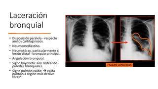 Laceración
bronquial
• Disposición paralela - respecto
anillos cartilaginosos.
• Neumomediastino.
• Neumotórax, particularmente si
lesión distal - bronquio principal.
• Angulación bronquial.
• Signo bayoneta: aire rodeando
paredes bronquiales.
• Signo pulmón caído:  caída
pulmón a región más declive
tórax*
 