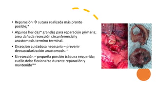 • Reparación  sutura realizada más pronto
posible;*
• Algunas heridas~ grandes para reparación primaria;
área dañada resección circunferencial y
anastomosis termino terminal.
• Disección cuidadosa necesaria – prevenir
desvascularización anastomosis. ~
• Si resección – pequeña porción tráquea requerida;
cuello debe flexionarse durante reparación y
mantenido**
 