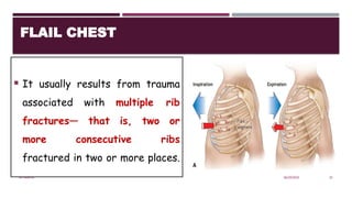 Chest trauma for anesthesia student.pptx