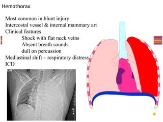 Hemothorax

 Most common in blunt injury
 Intercostal vessel & internal mammary art
 Clinical features
        Shock with flat neck veins
        Absent breath sounds
        dull on percussion
 Mediastinal shift – respiratory distress
 ICD
 