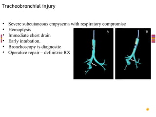 Tracheobronchial injury


•   Severe subcutaneous empysema with respiratory compromise
•   Hemoptysis
•   Immediate chest drain
•   Early intubation.
•   Bronchoscopy is diagnostic
•   Operative repair – definitvie RX
 