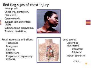 Red flag signs of chest injury
 Hemoptysis.
 Chest wall contusion.
 Flail chest.
 Open wounds.
 Jugular vein distention
  (JVD).
 Subcutaneous empysema.
 Tracheal deviation.


Respiratory rate and effort:         Lung sounds:
   Tachypnea                            Absent or
   Bradypnea                            decreased
   Labored                                  Unilateral
   Retractions                              Bilateral
   Progressive respiratory              Bowel sounds in
   distress
                                             chest.
 