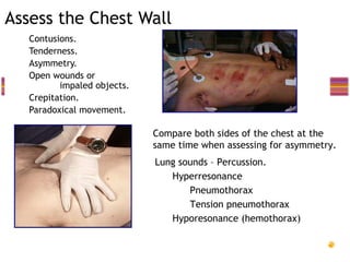 Assess the Chest Wall
  Contusions.
  Tenderness.
  Asymmetry.
  Open wounds or
          impaled objects.
  Crepitation.
  Paradoxical movement.

                              Compare both sides of the chest at the
                               same time when assessing for asymmetry.
                                Lung sounds – Percussion.
                                   Hyperresonance
                                       Pneumothorax
                                       Tension pneumothorax
                                   Hyporesonance (hemothorax)
 