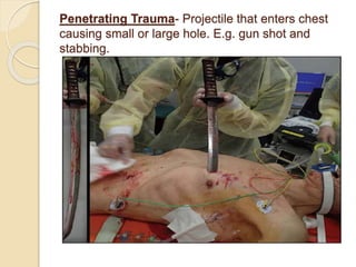 Penetrating Trauma- Projectile that enters chest
causing small or large hole. E.g. gun shot and
stabbing.
 