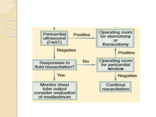 Chest trauma seminar