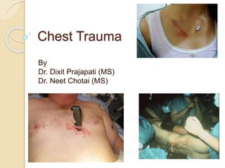 Chest Trauma
By
Dr. Dixit Prajapati (MS)
Dr. Neet Chotai (MS)
 