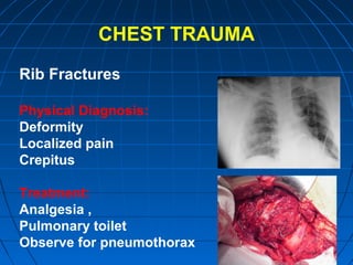 CHEST TRAUMA
Rib Fractures
Physical Diagnosis:
Deformity
Localized pain
Crepitus
Treatment:
Analgesia ,
Pulmonary toilet
Observe for pneumothorax
 