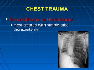 CHEST TRAUMA
 Pneumothorax or HemothoraxPneumothorax or Hemothorax
• most treated with simple tubemost treated with simple tube
thoracostomythoracostomy
 