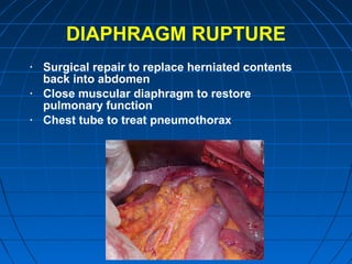 DIAPHRAGM RUPTURE
• Surgical repair to replace herniated contents
back into abdomen
• Close muscular diaphragm to restore
pulmonary function
• Chest tube to treat pneumothorax
 
