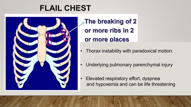 Chest Trauma MBBS teaching in Lilongwe Malawi | PPT
